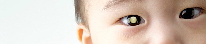 Pioneering New Approaches To Infant Eye Cancer Research