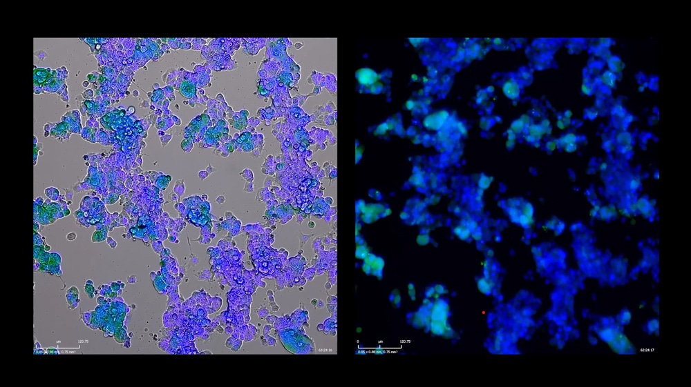 Imaging Oncolytic Virus-Mediated Killing