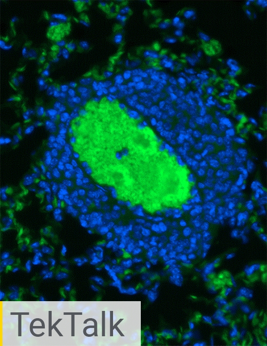 Advancing Cancer Cell Invasion and Metastasis Research with Powerful Cell Analysis Tools