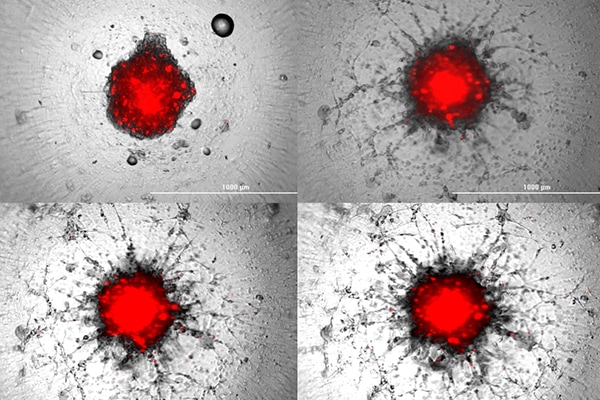 Navigating the cell migration assay landscape: How to bring together the most appropriate tools and approaches to ensure robust, accurate results