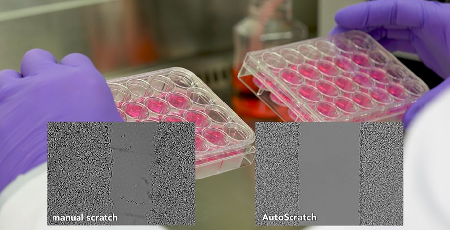 In Vitro Cell Migration Assays