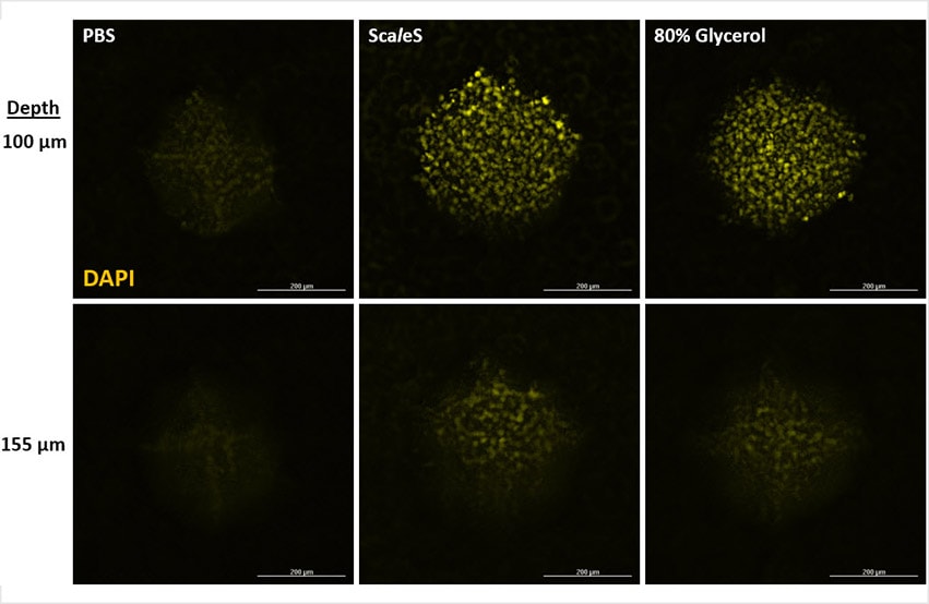 Confocal Fluorescence Imaging