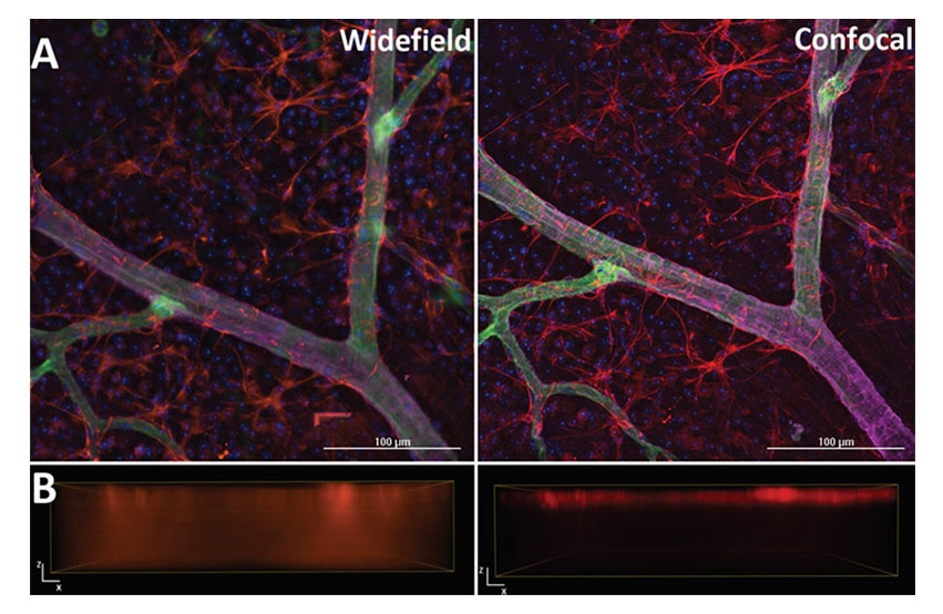 Confocal Fluorescence Imaging