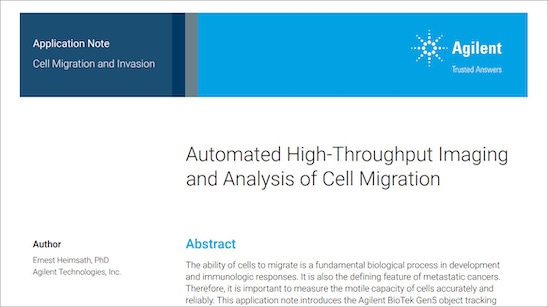 Automated High-Throughput Imaging and Analysis of Cell Migration