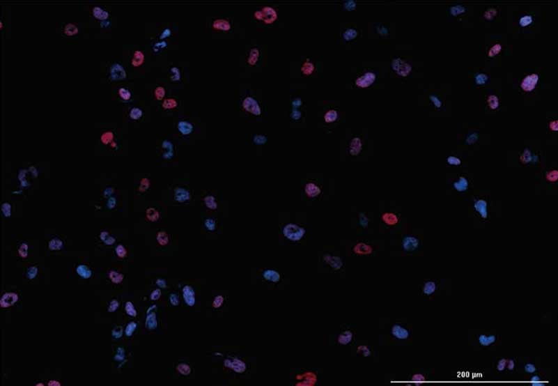 Automated Imaging and Dual-Mask Spot Counting of γH2AX Foci to Determine DNA Damage on an Individual Cell Basis