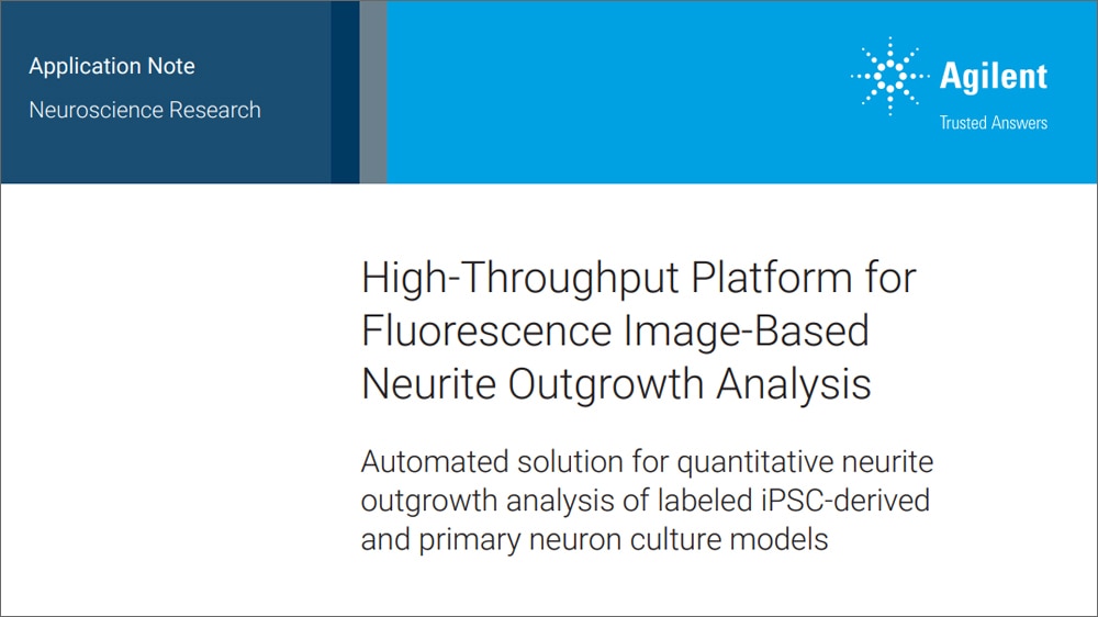 High-Throughput Platform for Fluorescence Image-Based Neurite Outgrowth Analysis