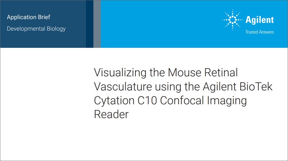 Visualizing the Mouse Retinal Vasculature using the Agilent BioTek Cytation C10 Confocal Imaging Reader