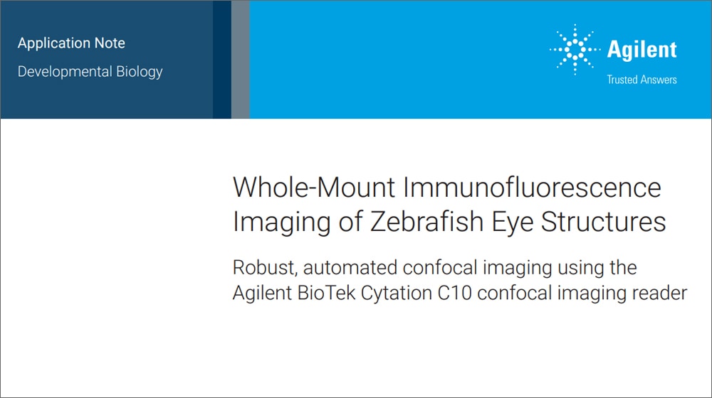 Whole-Mount Immunofluorescence Imaging of Zebrafish Eye Structures 