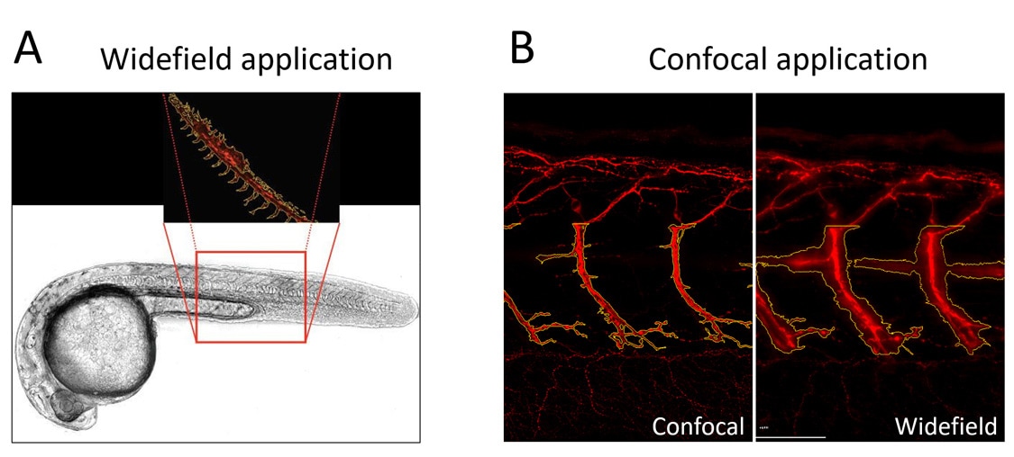 Widefield and confocal fluorescence microscopy applications for zebrafish phenotypic analysis.