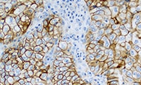 PD-L1 IHC 22C3 pharmDx product image