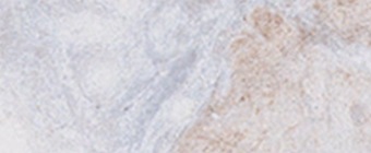 Cervical Cancer e-Learning teaser image