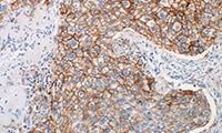 NSCLC Online Atlas of Stains teaser image