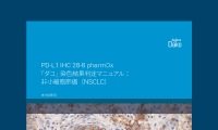 PD-L1 IHC 28-8 pharmDx「ダコ」の非小細胞肺癌染色結果判定マニュアル