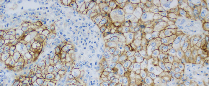 Image of the PD-L1 IHC 22C3 pharmDx NSCLC Interpretation Manual