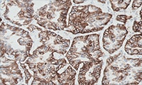 NSCLC Online Atlas of Stains teaser image