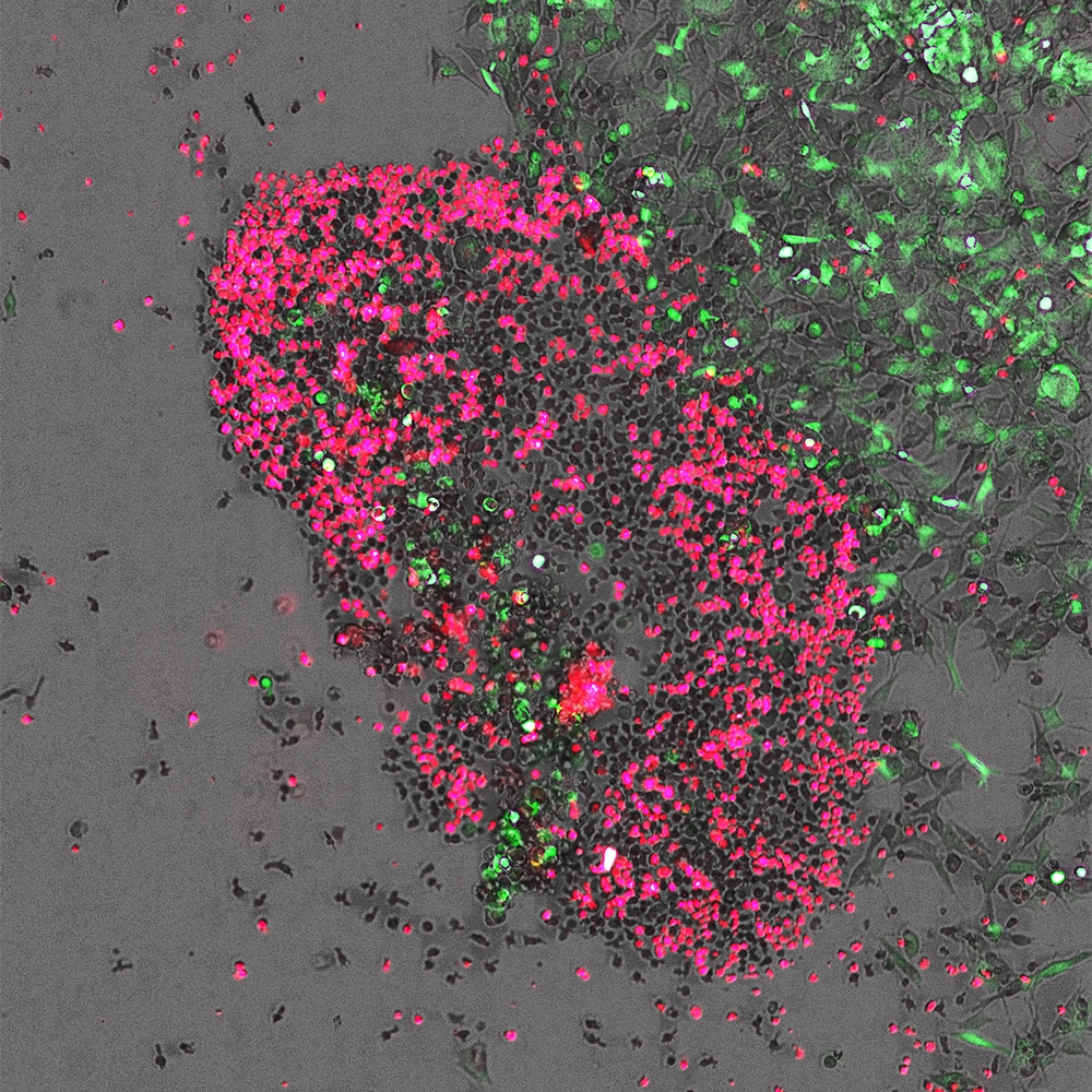 Neuroblastoma cancer cells (in green) being targeted and killed by primary human natural killer cell (in red) following treatment with a pro-immunomodulatory agent.  Live cell imaging was performed using a Cytation 5 at 10x using two channel fluorescence and brightfield imaging. 