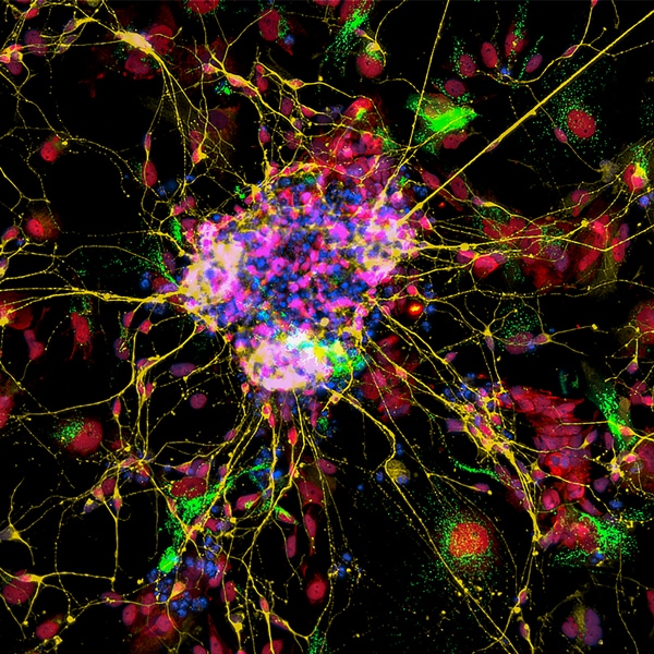 Cortical neuron differentiated from human pluripotent stem cell stained with Tuj1 (yellow), O-GlcNAcylation (red), mitochondria (green), and DAPI. Image was taken at a 10x magnification with automatic image processing.