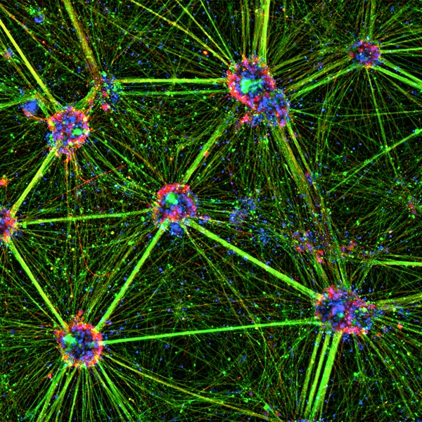 Human pluripotent stem cell-derived sympathetic neurons. Image was taken at 10x, and stained for peripherin (green), tyrosine hydroxylase (red) and DAPI (blue). Image captured with Lionheart FX. Summited for the 2021 Imaging contest by Hsueh Fu Wu, University of Georgia