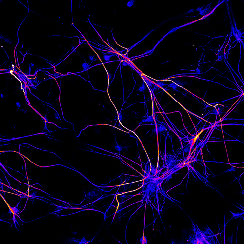 Cultured motor neurons from rat spinal cord grown for 2 weeks invitro labeled with the axonal marker neurofilament by immunocytochemistry. 