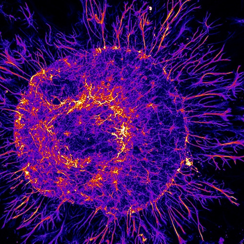Fireball of astrocytes- Rat astrocytes labeled with glial fibrillary acidic protein. 
Image captured with 20X objective as Z stack and projected by maximum fluorescence intensity.