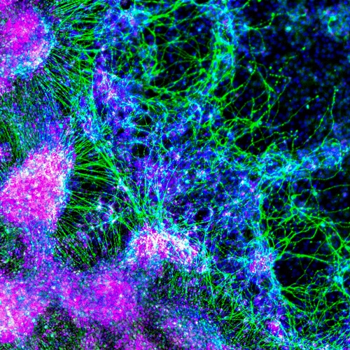 Neural crest cells and sensory neurons differentiated from human pluripotent stem cells stained for SOX10 (magenta), TUJ1 (green), and DAPI (blue). Image was taken using a Lionheart FX (manual mode) at a 4X magnification.