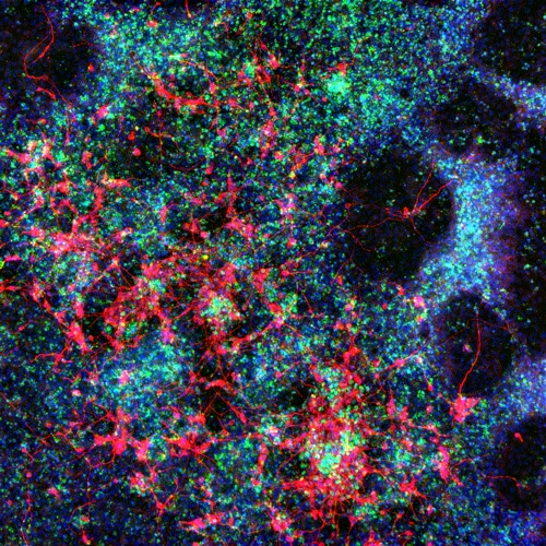 Neural crest cells and sensory neurons differentiated from human pluripotent stem cells stained fro SOX10 (green), TUJ1 (red), DAPI (blue). Image was taken using a Lionheart FX (manual mode) at a 4X magnification.