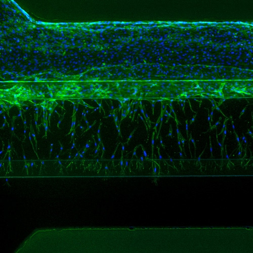 Angiogenic sprouts in Mimetas OrganoPlate, Cytation 5, 4X, fluorescent imaging (DAPI/RFP) with z-stacking every 25 um 