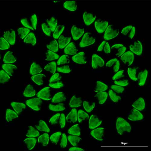Microalgae Botryococcus braunii