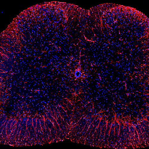 12 month old rat spinal cord labeled for astrocyte inflammatory marker glial fibrillary acidic protein (in red).