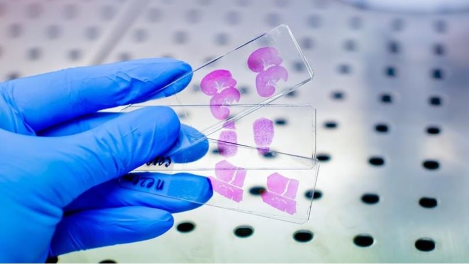 Gloved hand holding three thin sections of heart and kidney tissue mounted on glass microscope slides.
