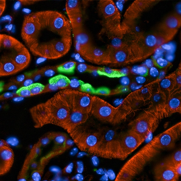 Immunolocalization of KCC4 (red) and H-ATPase (green) in kidney sections of mice. We can observe the cellular conformation of renal tubules and cell nuclei are stained with DAPI (Blue). Image was taken at a 20x magnification. Image captured with: Cytation 1
