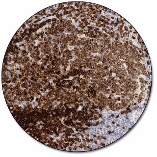 CD79a、B 細胞 (濃縮抗体)