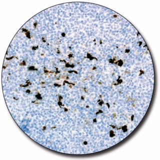 S100 (Autostainer Link 48)