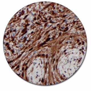 S100 (Autostainer Link 48)