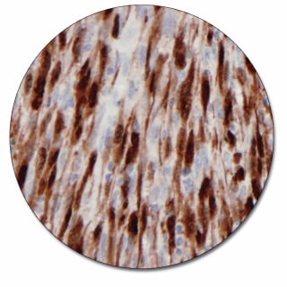 S100 (Autostainer Link 48)