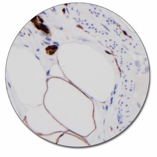 S100 (Autostainer Link 48)