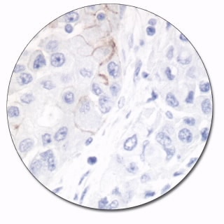 Epithelial Antigen (Autostainer Link 48)