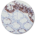 Ki-67 Antigen (Concentrate)