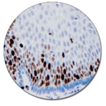 Ki-67 Antigen (Concentrate)