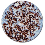 Ki-67 Antigen (Concentrate)