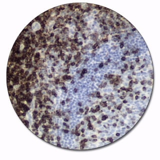 CD7 (Autostainer Link 48)
