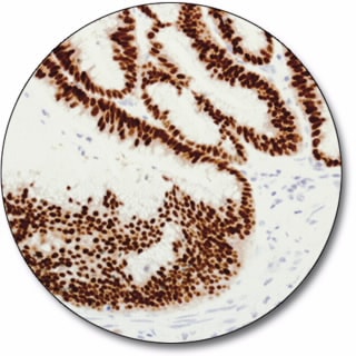 CDX2 (Autostainer Link 48)