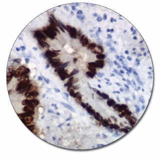 CDX2 (Autostainer Link 48)