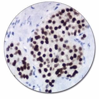 CDX2 (Autostainer Link 48)