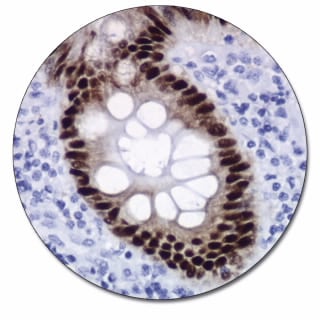 CDX2 (Autostainer Link 48)