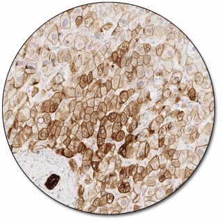 Cytokeratin 18 (Dako Omnis)