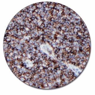 CD20cy (Concentrate)