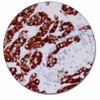 Hepatocyte (Concentrate)