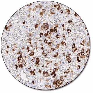 Hepatocyte (Dako Omnis)