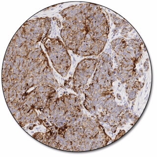 Cytokeratin 18 (Dako Omnis)